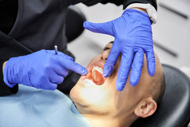 Best After-Hours Dental Trauma Care in Chevy Chase, MD